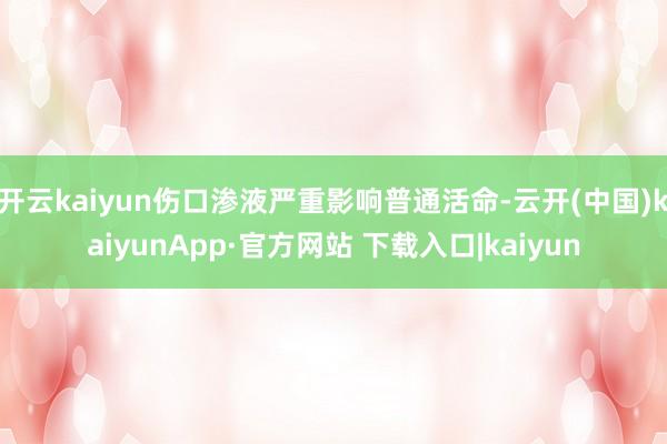 开云kaiyun伤口渗液严重影响普通活命-云开(中国)kaiyunApp·官方网站 下载入口|kaiyun